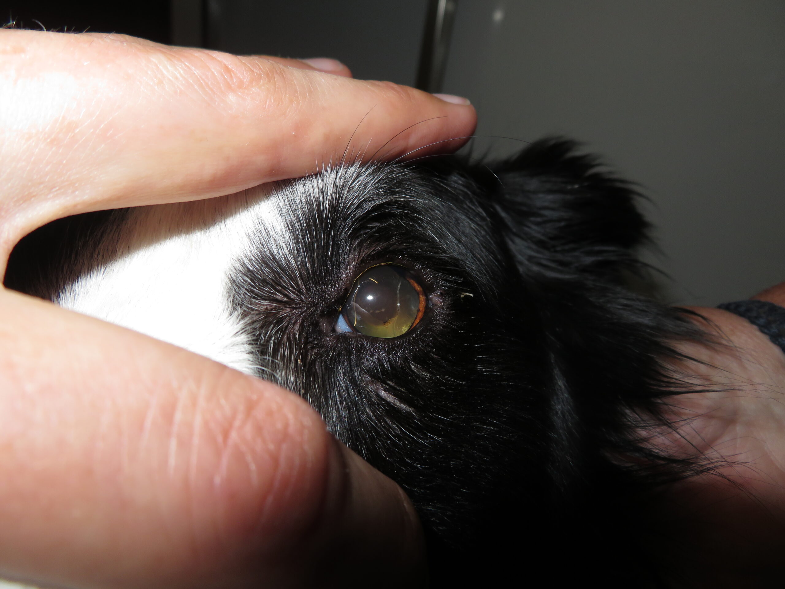 Cataracts