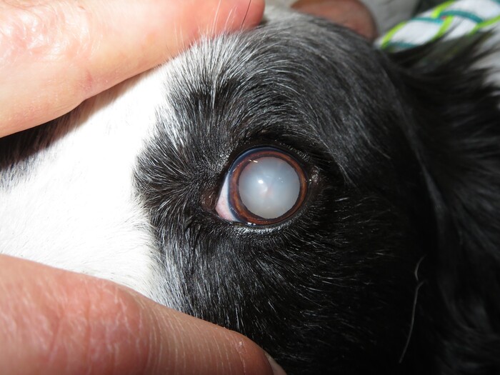 Cataracts